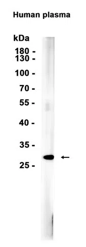 C1QB Rabbit Monoclonal Antibody