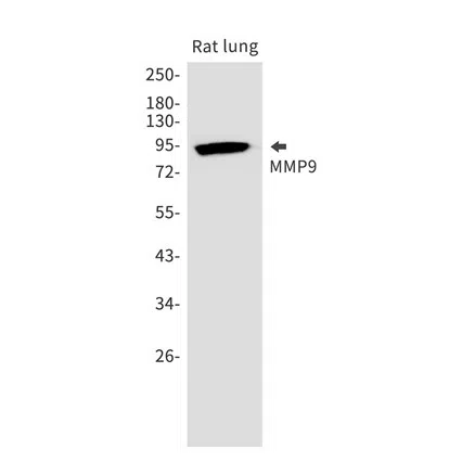 MMP9 Rabbit Monoclonal Antibody - Size: 50µl