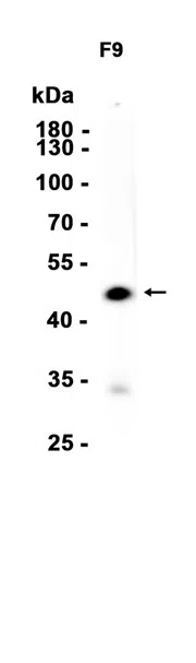Oct-6 Rabbit Monoclonal Antibody - Size: 100µl