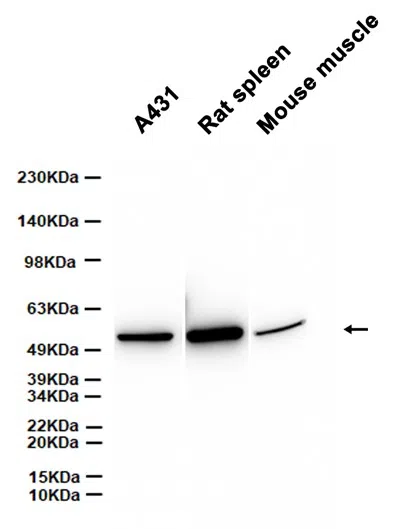 SEPT7 Rabbit Monoclonal Antibody - Size: 50µl