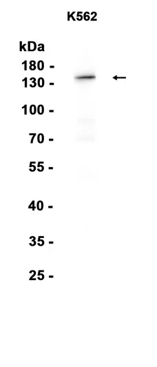 SMC3 Rabbit Monoclonal Antibody
