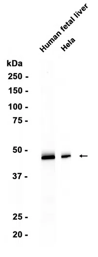 NADK2 Rabbit Monoclonal Antibody - Size: 50µl