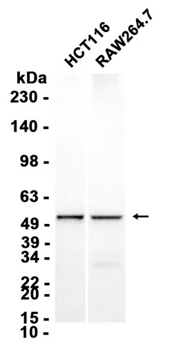 SUFU Rabbit Monoclonal Antibody - Size: 100µl