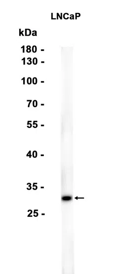 Nkx3.1 Rabbit Monoclonal Antibody - Size: 50µl