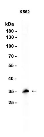 PSMD14 Rabbit Monoclonal Antibody - Size: 100µl