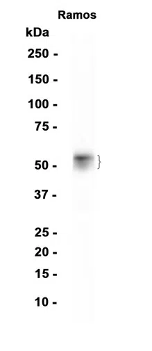 MEF2C Rabbit Monoclonal Antibody