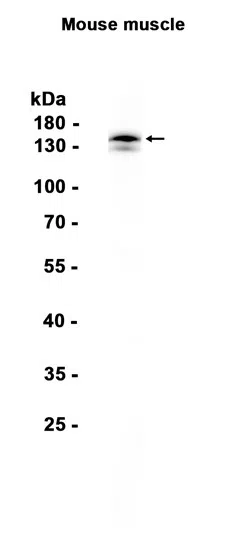 AGL Rabbit Monoclonal Antibody - Size: 100µl