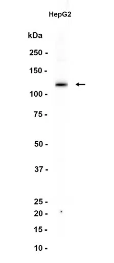 Fibrinogen alpha chain Rabbit Monoclonal Antibody - Size: 100µl