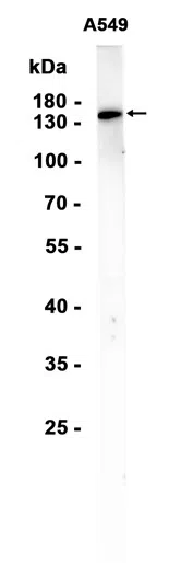 Integrin alpha 2 Rabbit Monoclonal Antibody - Size: 100µl