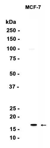 AGR3 Rabbit Monoclonal Antibody - Size: 100µl