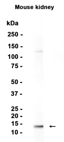 FABP4 Rabbit Monoclonal Antibody - Size: 50µl