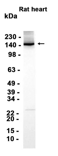 eNOS Rabbit Monoclonal Antibody - Size: 50µl