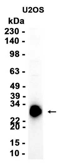 TIMP1 Rabbit Monoclonal Antibody - Size: 50µl