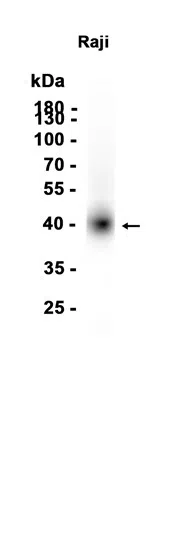 CD38 Rabbit Monoclonal Antibody