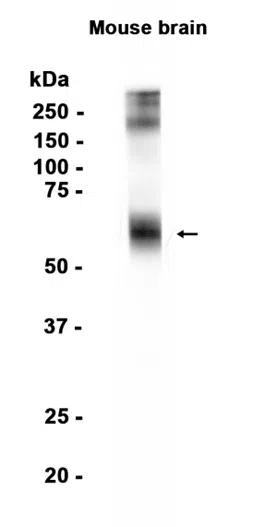 EAAT2 Rabbit Monoclonal Antibody - Size: 100µl