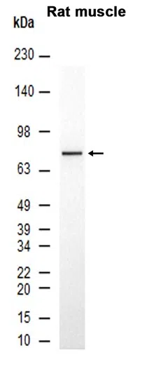 GRK3 Rabbit Monoclonal Antibody - Size: 50µl