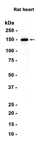 MYBPC3 Rabbit Monoclonal Antibody - Size: 50µl