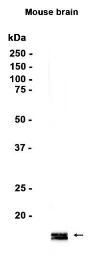 alpha/beta Synuclein Rabbit Monoclonal Antibody - Size: 50µl