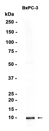 S100P Rabbit Monoclonal Antibody - Size: 100µl