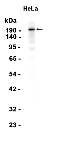 Baf180 Rabbit Monoclonal Antibody - Size: 50µl