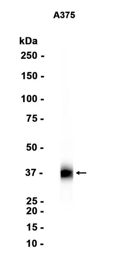 SFRP1 Rabbit Monoclonal Antibody - Size: 50µl