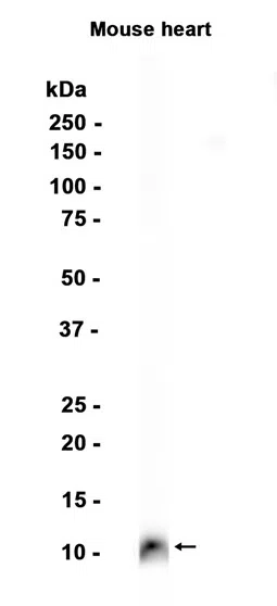 S100 alpha Rabbit Monoclonal Antibody