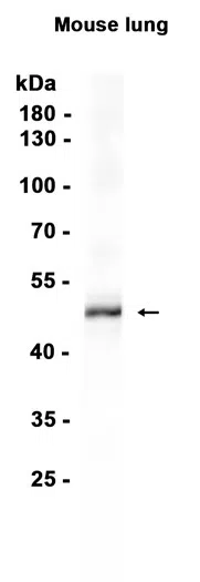 Cytokeratin 13 Rabbit Monoclonal Antibody - Size: 50µl