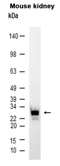 MUC1 Rabbit Monoclonal Antibody