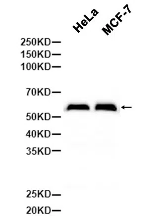 Smad1 Rabbit Monoclonal Antibody - Size: 50µl