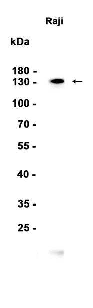 CD21 Rabbit Monoclonal Antibody - Size: 50µl