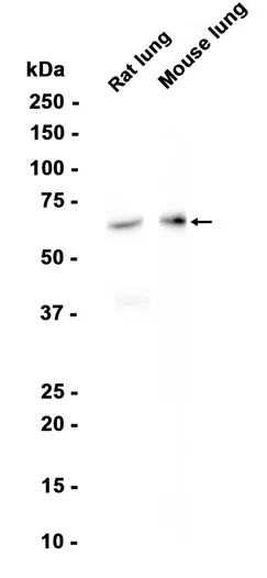 MMP8 Rabbit Monoclonal Antibody - Size: 100µl