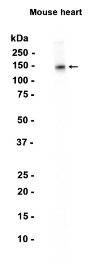 Natriuretic Peptide Receptor B Rabbit Monoclonal Antibody - Size: 50µl