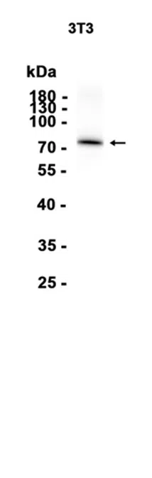 ABCD1 Rabbit Monoclonal Antibody - Size: 50µl
