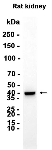 ALDOB Rabbit Monoclonal Antibody - Size: 50µl