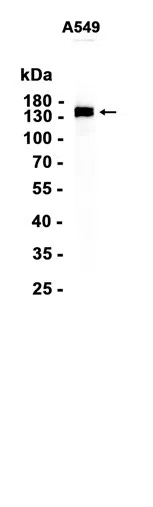 EGFR Rabbit Monoclonal Antibody - Size: 100µl