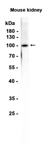 CD10 Rabbit Monoclonal Antibody