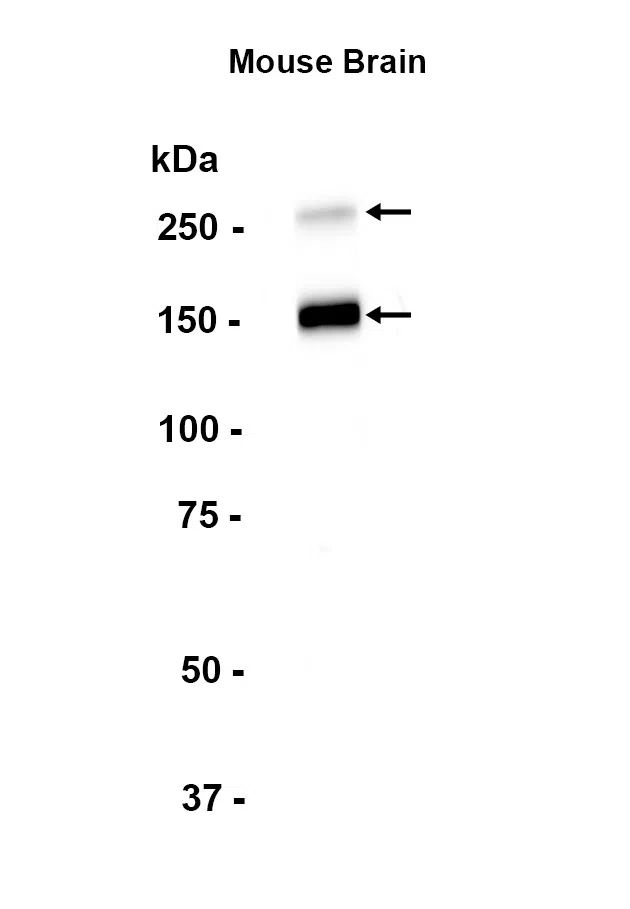 L1CAM Rabbit Monoclonal Antibody - Size: 100µl