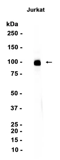 CD6 Rabbit Monoclonal Antibody - Size: 50µl
