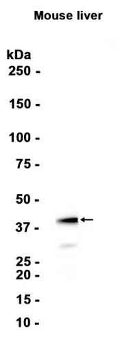 Alcohol Dehydrogenase Rabbit Monoclonal Antibody - Size: 100µl