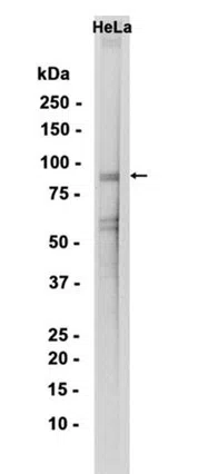 UBF1 Rabbit Monoclonal Antibody