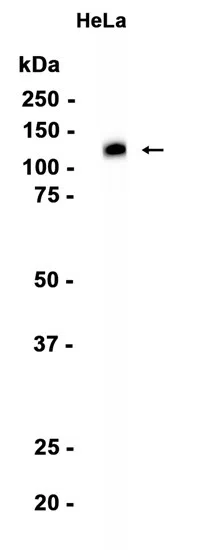 SMG5 Rabbit Monoclonal Antibody - Size: 50µl