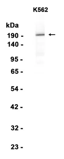 WRN Rabbit Monoclonal Antibody - Size: 100µl