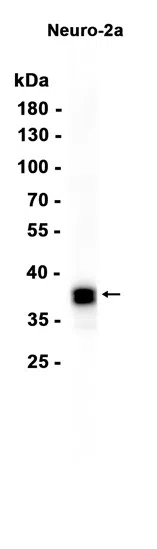 PHOX2B Rabbit Monoclonal Antibody - Size: 50µl