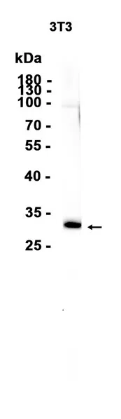CITED2 Rabbit Monoclonal Antibody - Size: 100µl