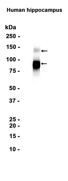 TrkB Rabbit Monoclonal Antibody - Size: 50µl