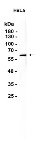 MMP13 Rabbit Monoclonal Antibody