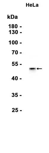 Pygopus 2 Rabbit Monoclonal Antibody - Size: 100µl