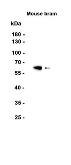 Calcineurin A Rabbit Monoclonal Antibody - Size: 50µl