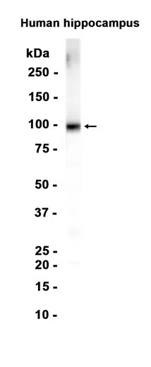 Glutamate receptor 3 Rabbit Monoclonal Antibody - Size: 50µl