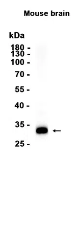 Calretinin Rabbit Monoclonal Antibody - Size: 100µl